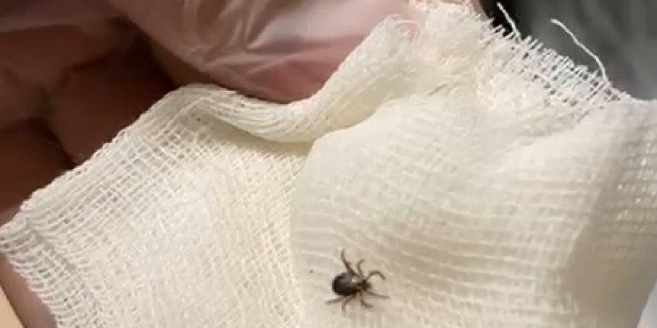 Kene Paniği Hastanede Bitti