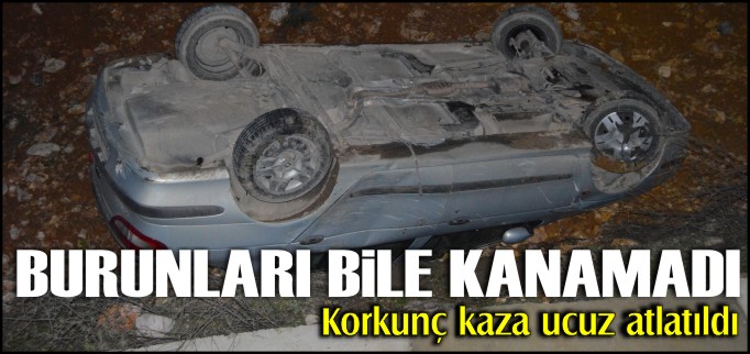 BURUNLARI BİLE KANAMADI