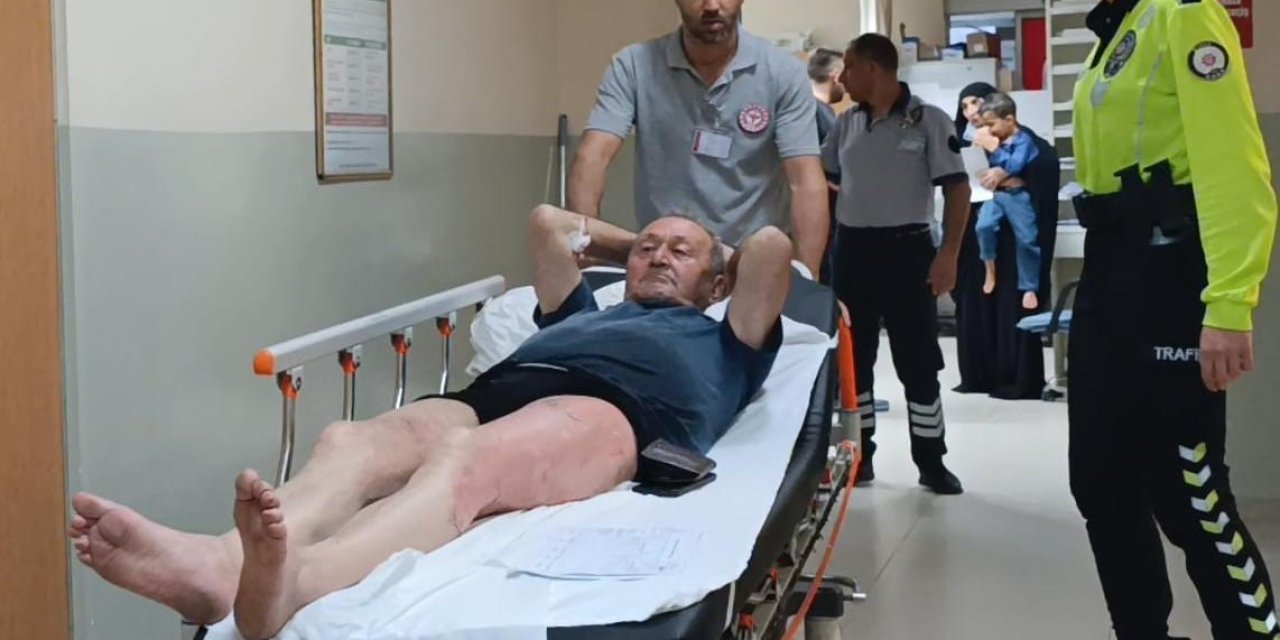 Üzerine Kaynar Su Döküldü