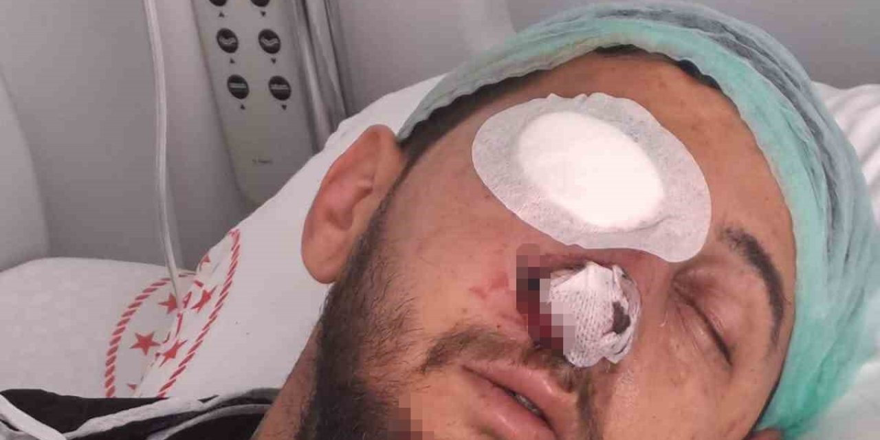 Düğün Eğlencesi Kabusa Döndü: Sağ Gözünden Oldu