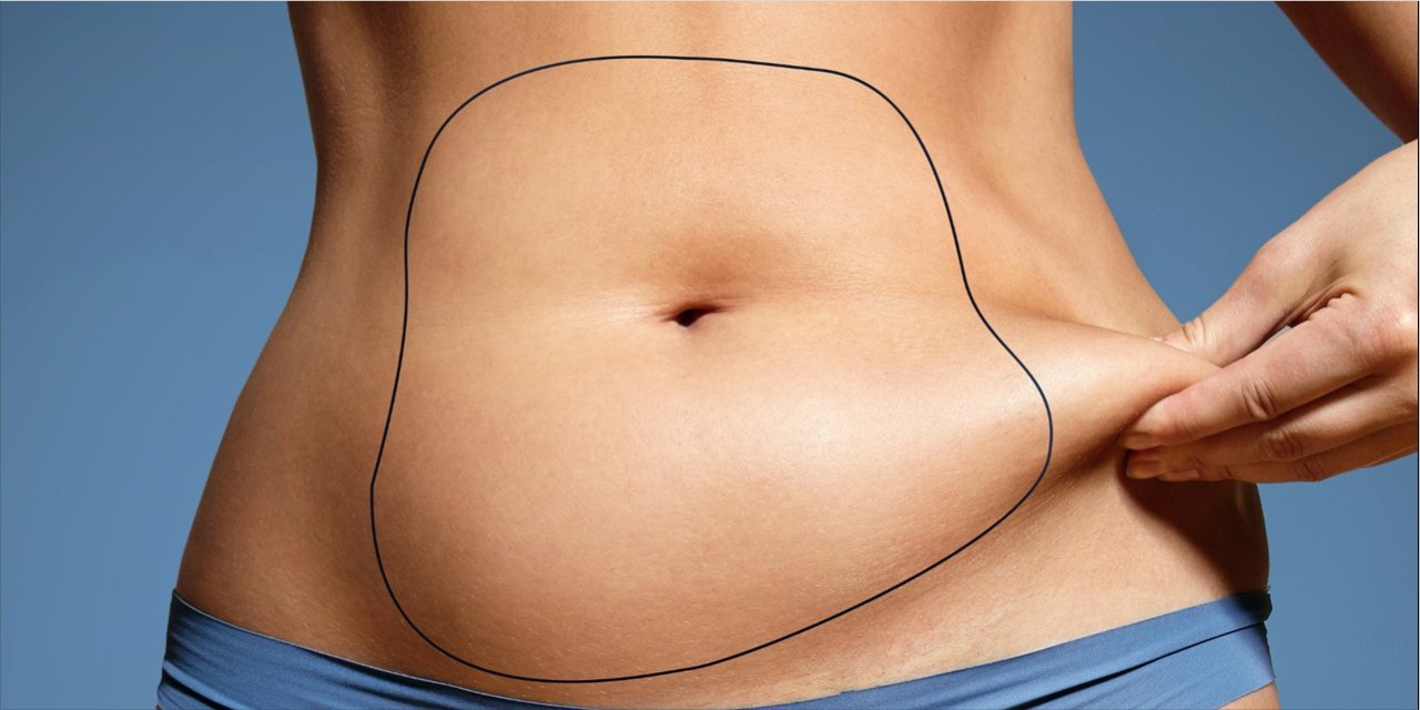 Karın Germe Ameliyatı ile Aynadaki Farkı Hissedin