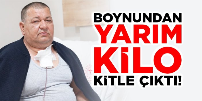 Bilecik'te 54 yaşındaki hastanın boynundan yarım kilo kitle çıktı