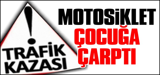 MOTOSİKLET ÇOCUĞA ÇARPTI