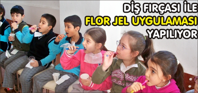 DİŞ FIRÇASI İLE FLOR JEL UYGULAMASI YAPILIYOR