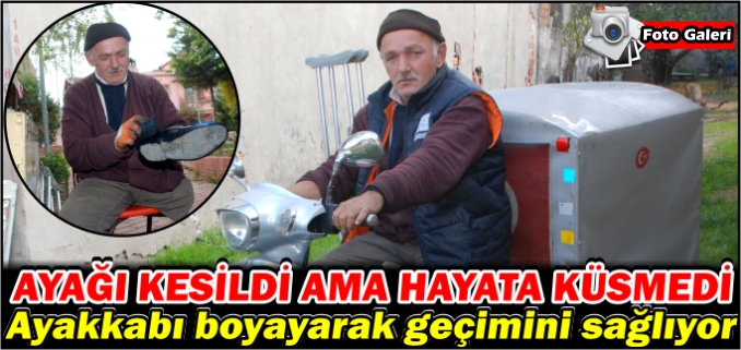 AYAĞI KESİLDİ AMA HAYATA KÜSMEDİ
