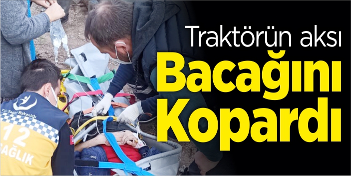 Traktörün aksı bacağını kopardı