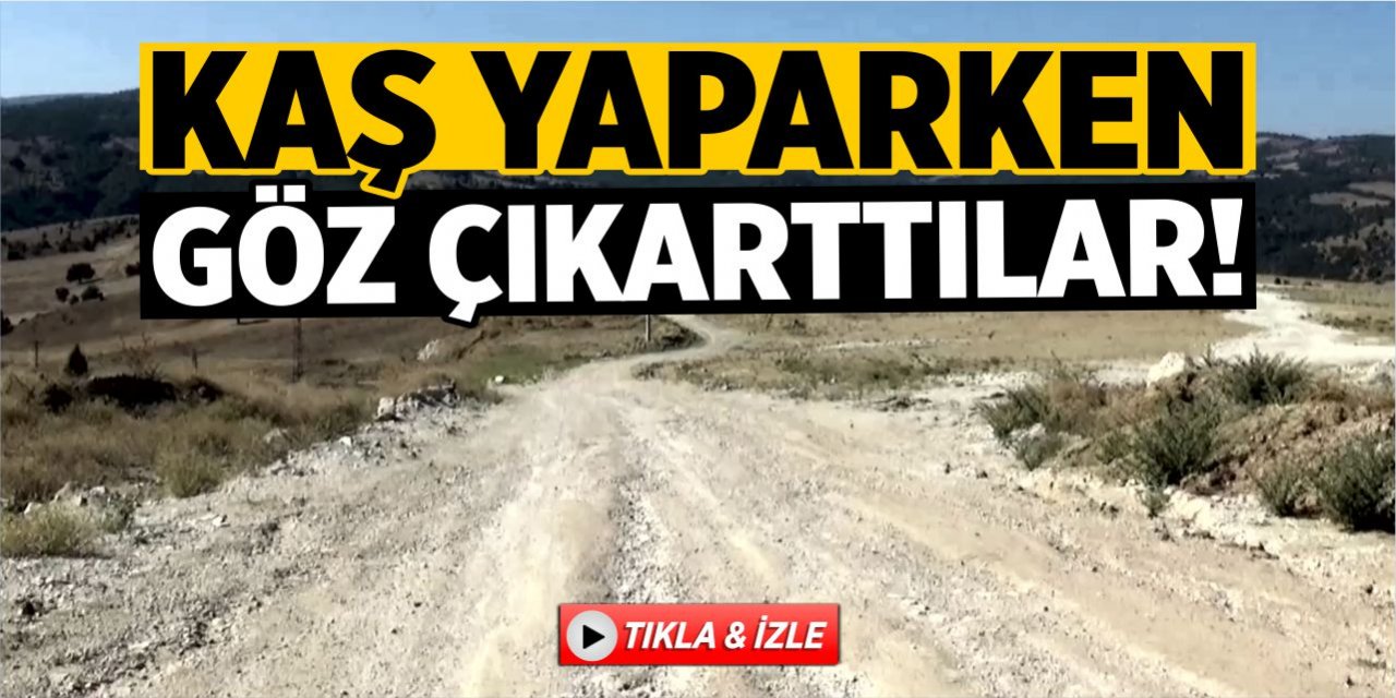 Kaş yaparken göz çıkarttılar!