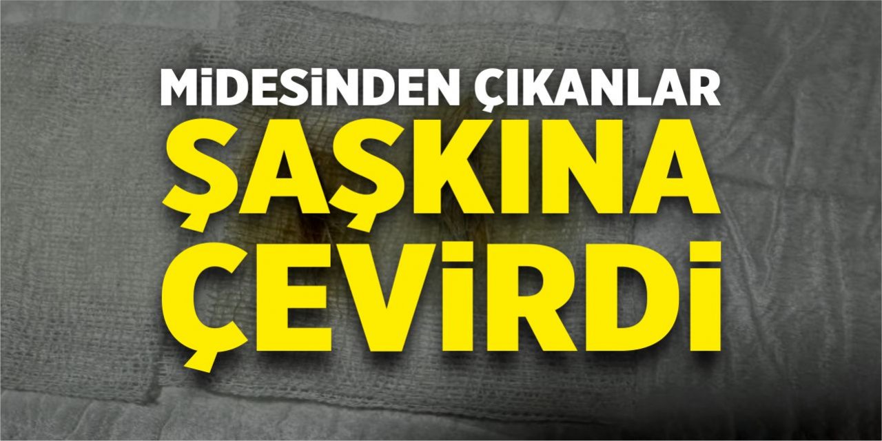 Midesinden çıkanlar şaşkına çevirdi!