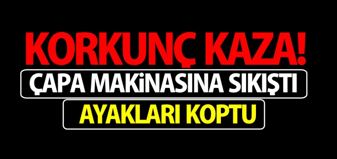 AYAKLARI KOPTU