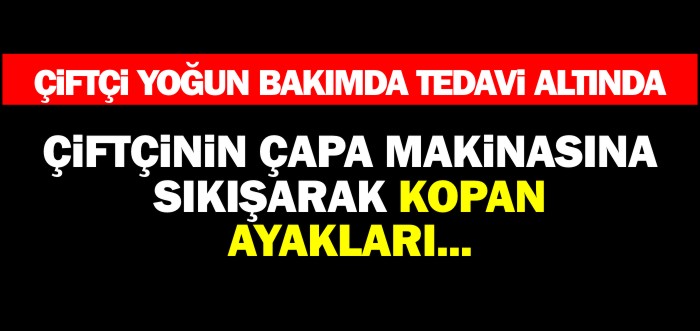 ÇİFTÇİNİN KOPAN AYAKLARI