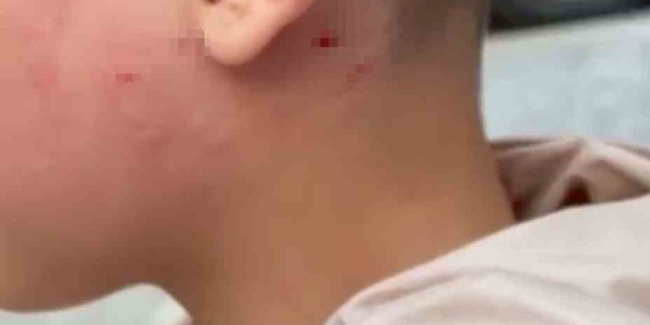 Camı Tıklattığı İçin Çocuğu Darp Etti