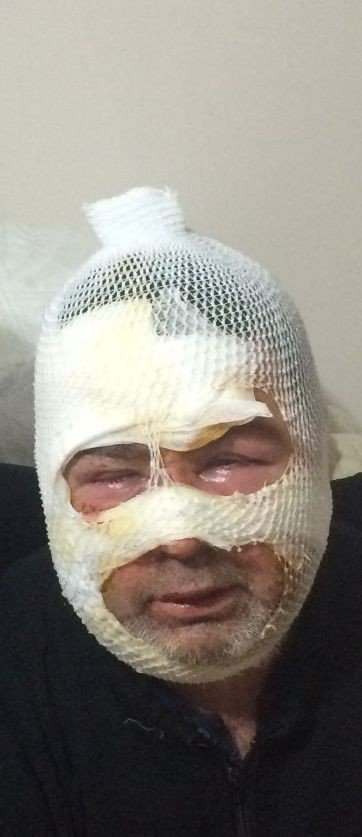 Uyurken dehşeti yaşadı