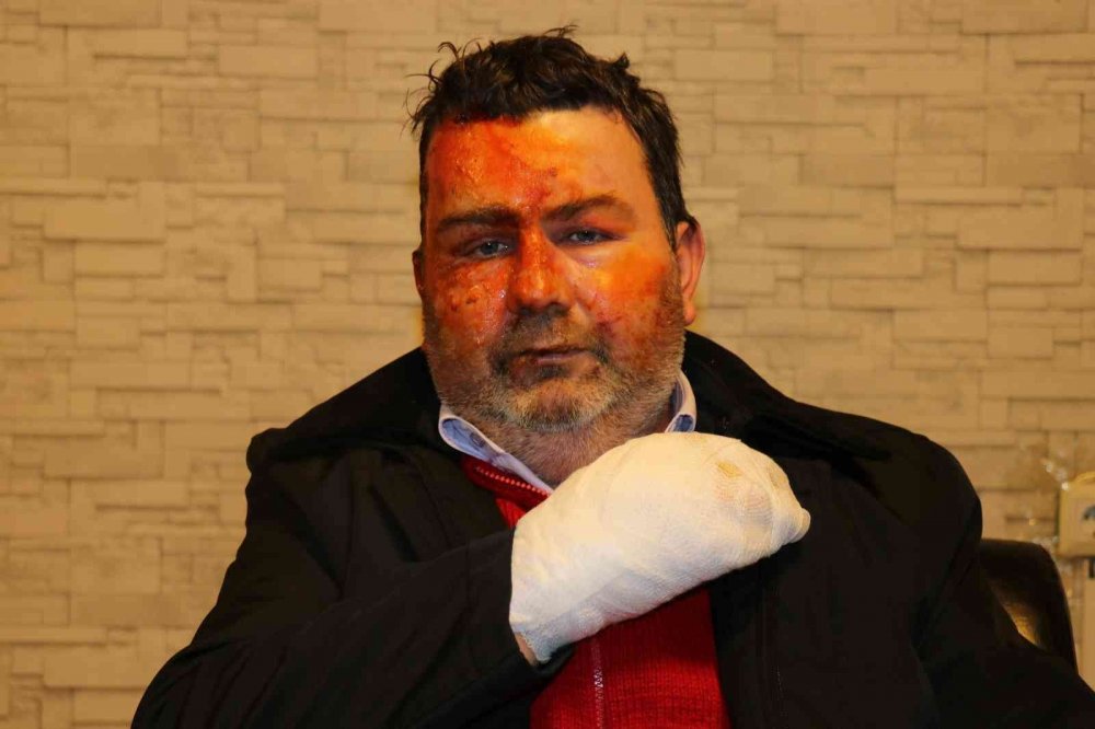 Uyurken dehşeti yaşadı