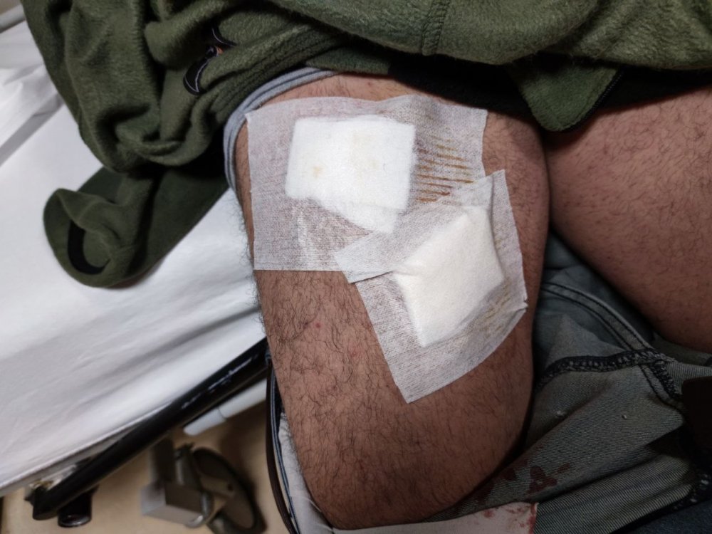 Tarladaki çiftçi köpeklerin saldırısına uğradı