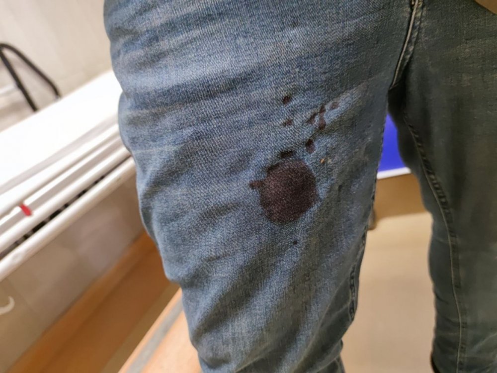 Tarladaki çiftçi köpeklerin saldırısına uğradı