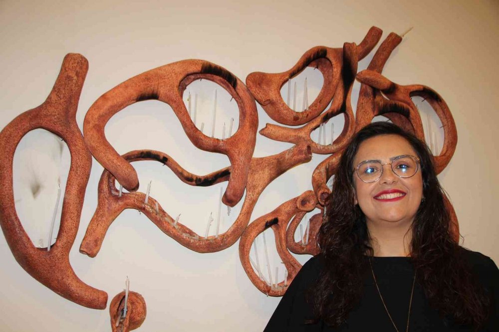 Tüp mide ameliyatı oldu, lisans bitirme projesi olarak mideleri seçti