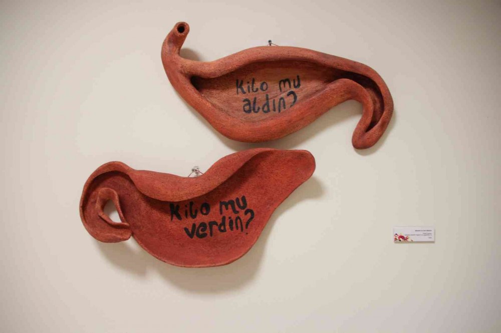 Tüp mide ameliyatı oldu, lisans bitirme projesi olarak mideleri seçti