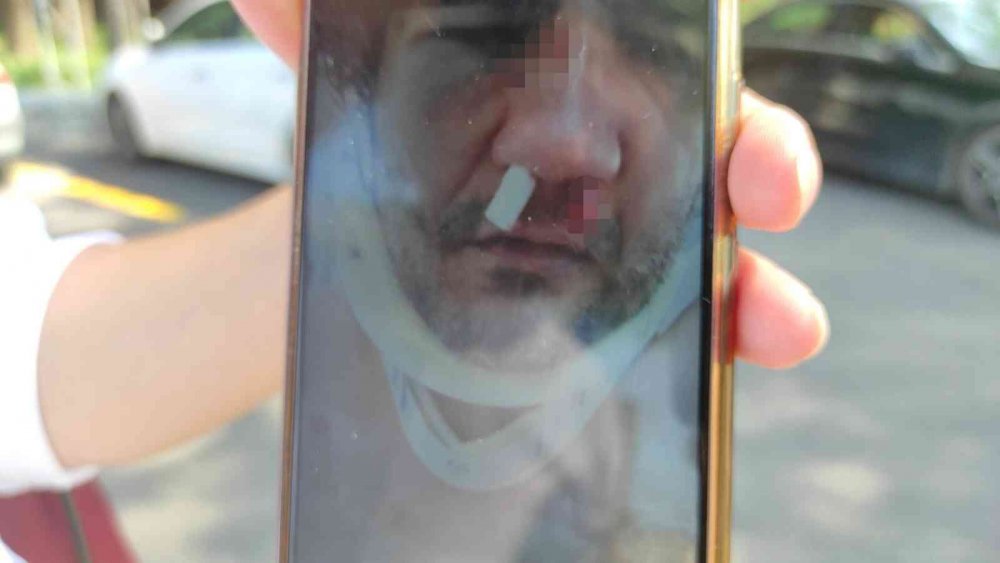 Nafaka yüzünden öldüresiye dövüldü