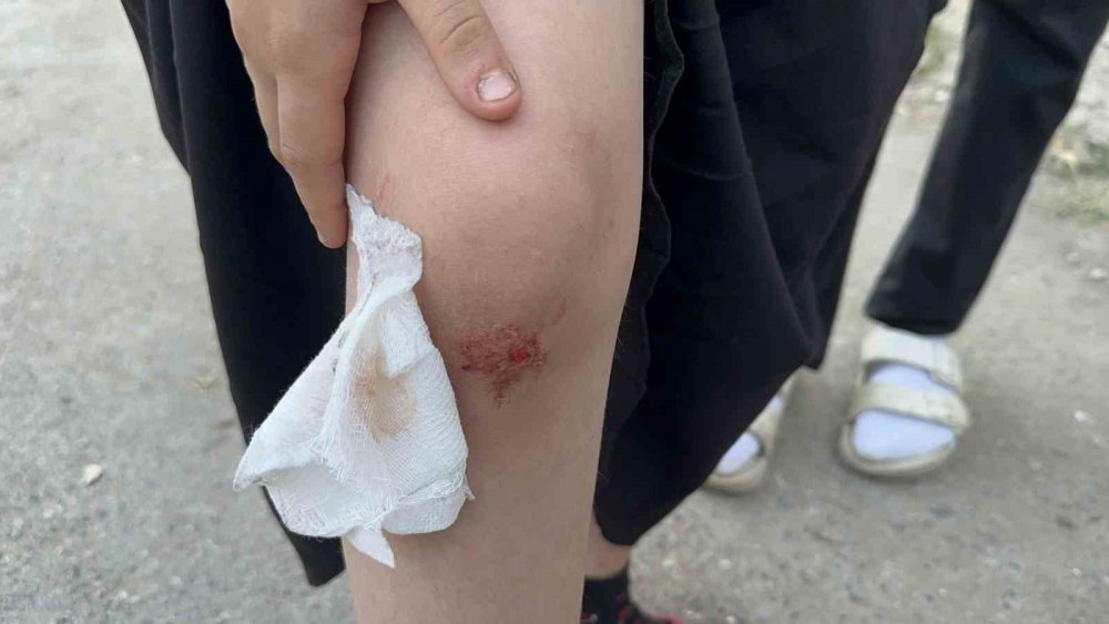 Okula Giderken Sokak Köpeğinin Saldırısına Uğradı