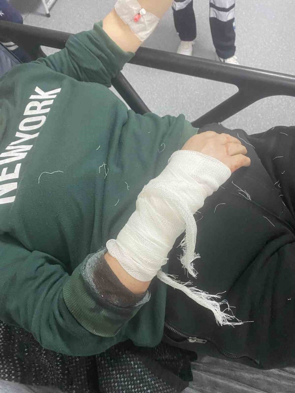 Beslediği Köpeğin Aynı Cinsi Tarafından Sokakta Saldırıya Uğradı, Dehşet Anlarını Böyle Anlattı