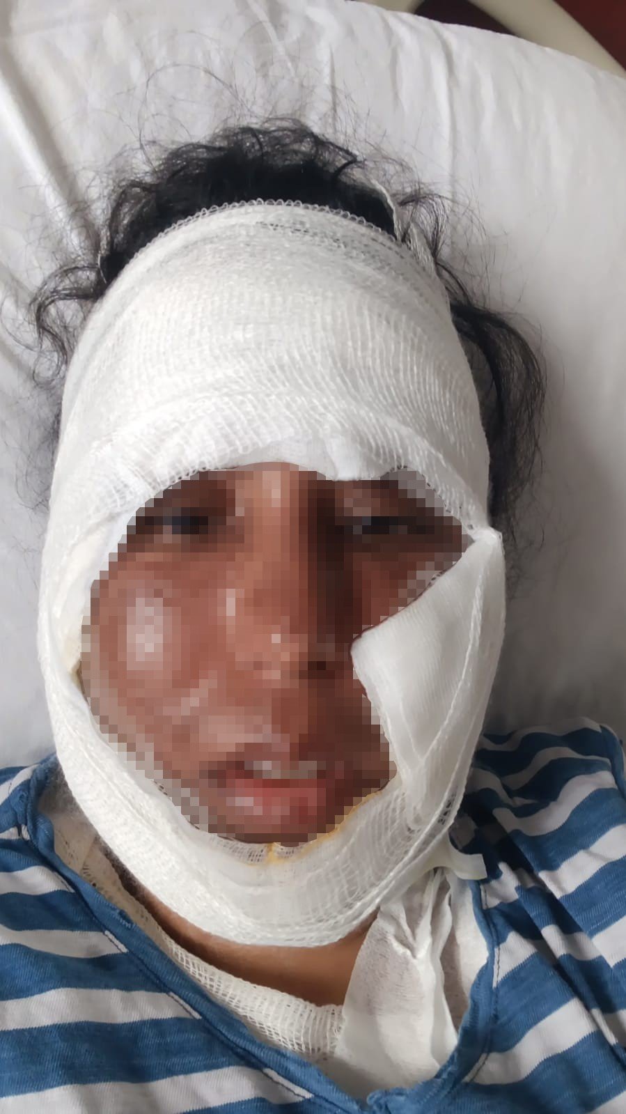 Gelin Görümce Tartışması Hastanede Son Buldu