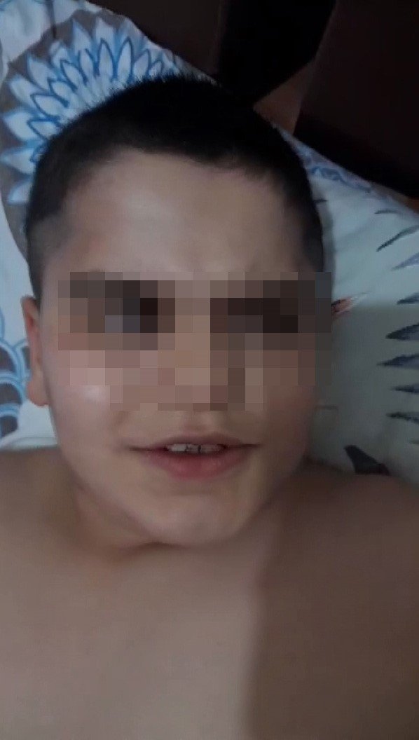 Otizm Hastası Çocuk, Öğretmeni Tarafından Darp Edildi İddiası