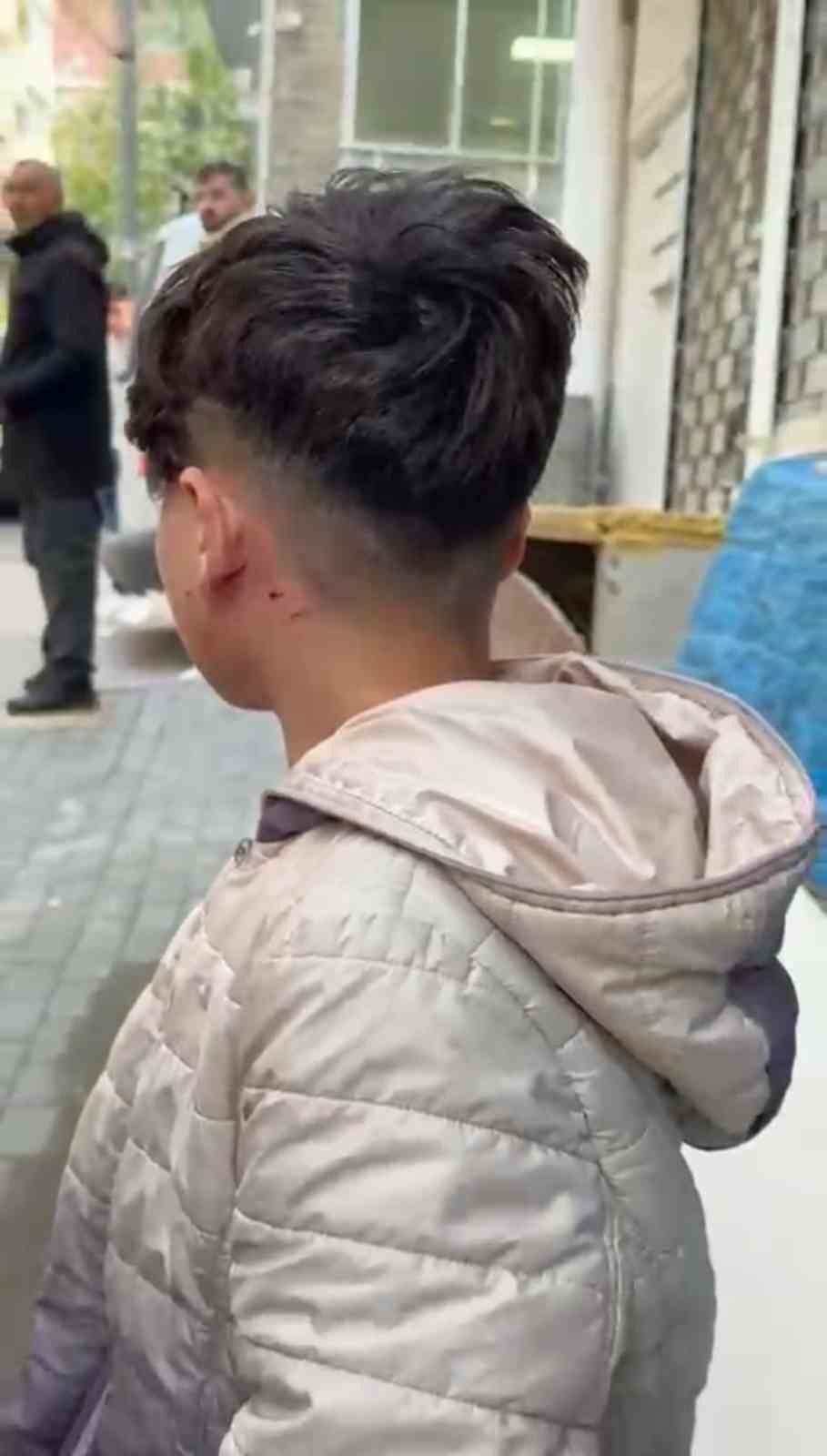 Camı Tıklattığı İçin Çocuğu Darp Etti