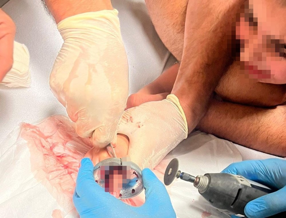 Çocuğun Parmağı Çeşme Aynasına Sıkıştı