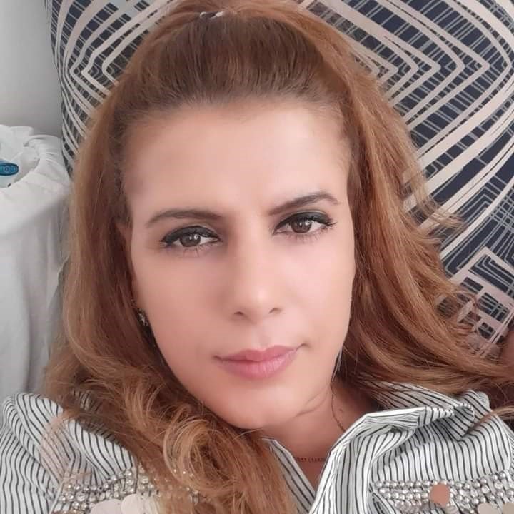 Genç Kadının Hayatı Kezzapla Karardı