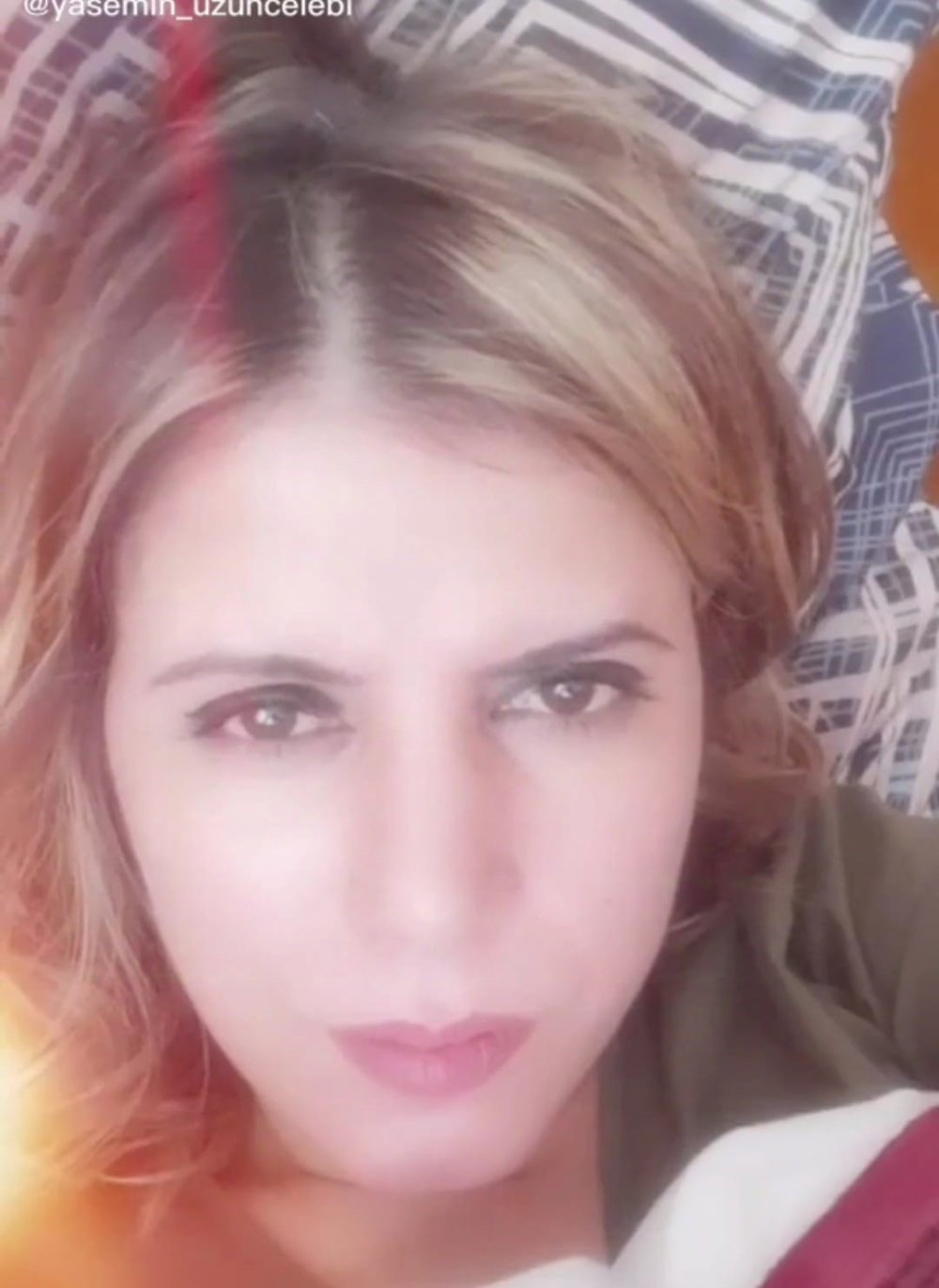 Genç Kadının Hayatı Kezzapla Karardı