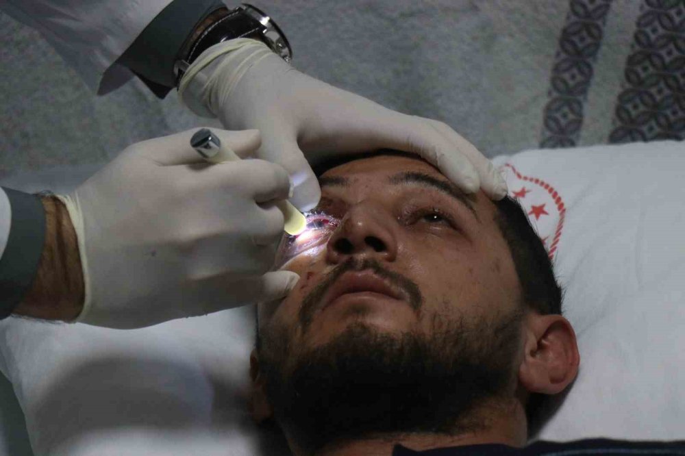 Düğün Eğlencesi Kabusa Döndü: Sağ Gözünden Oldu