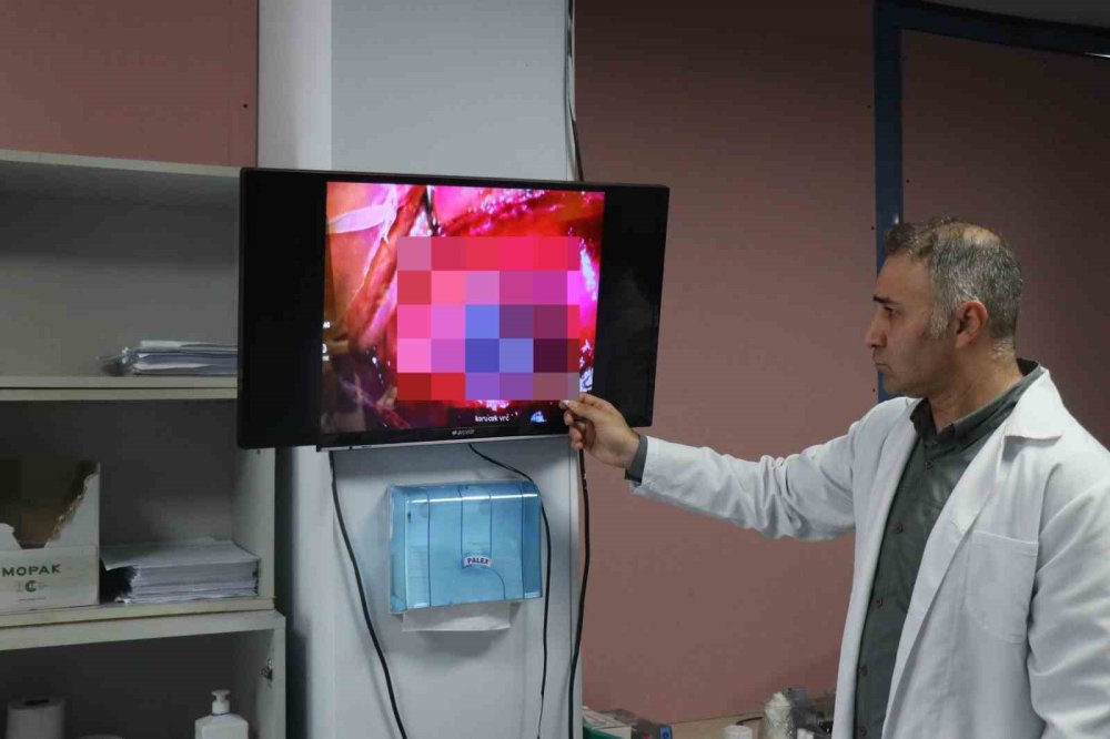 Düğün Eğlencesi Kabusa Döndü: Sağ Gözünden Oldu