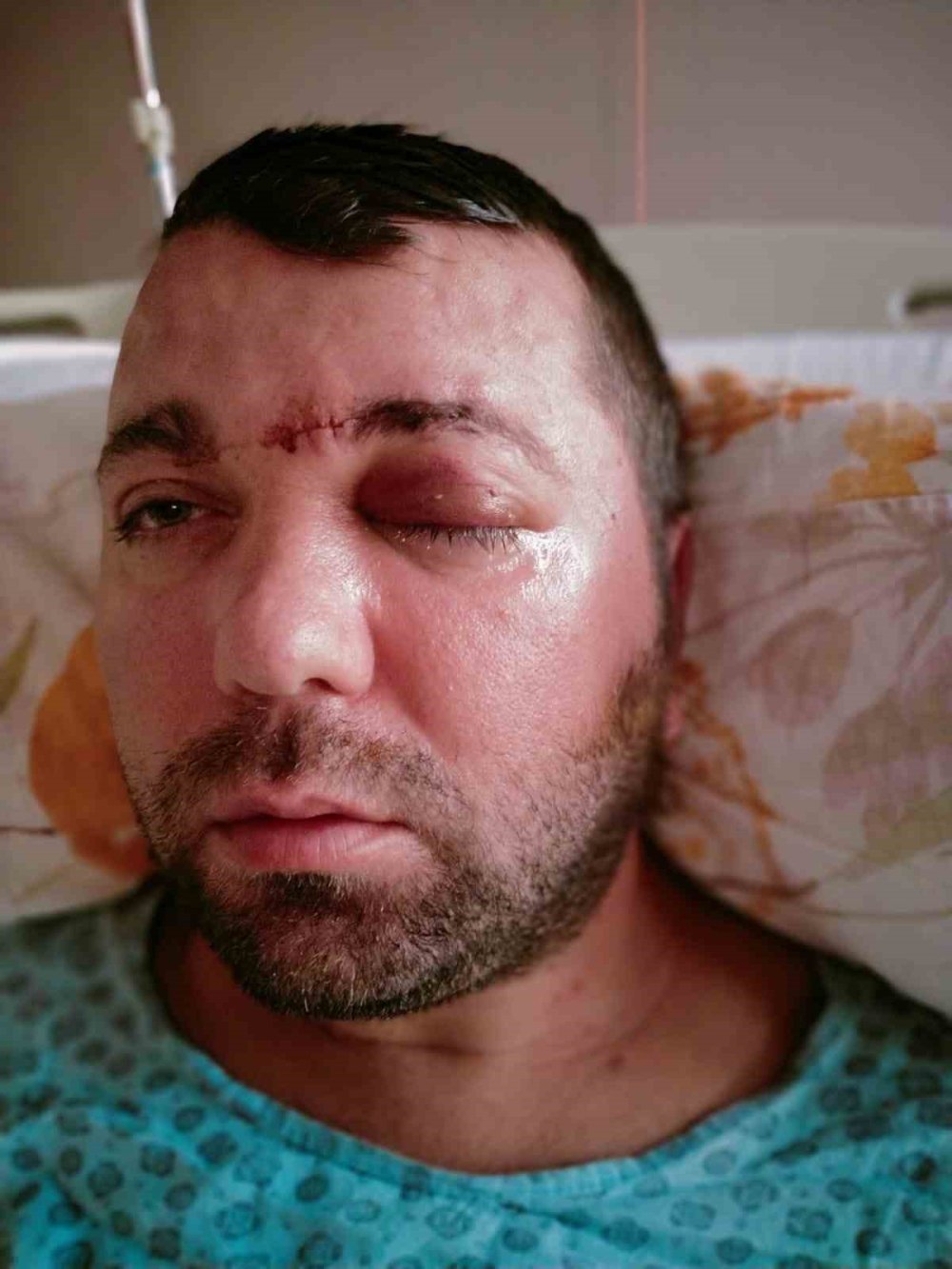 Beynine Saplanan İmplant Hayatını Kararttı: 2 Yıldır Adalet Bekliyor