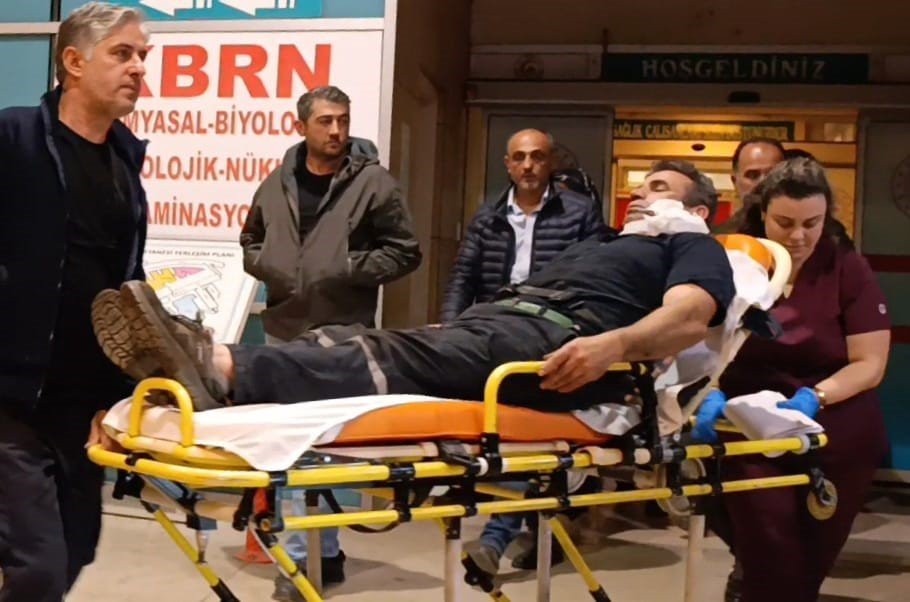 Kömürleri İndirirken Yüzüne Demir Saplandı