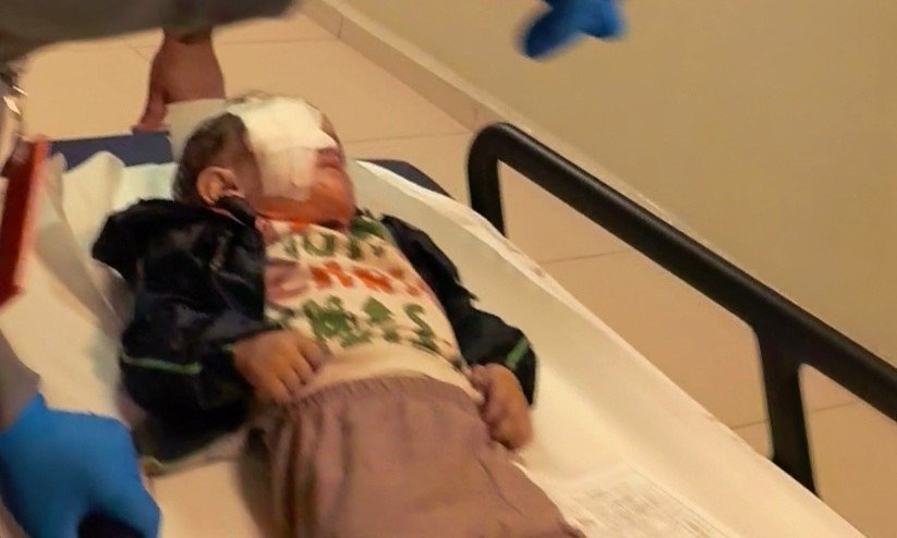 Torpil Faciasında 2 Yaşındaki Çocuk Ağır Yaralandı