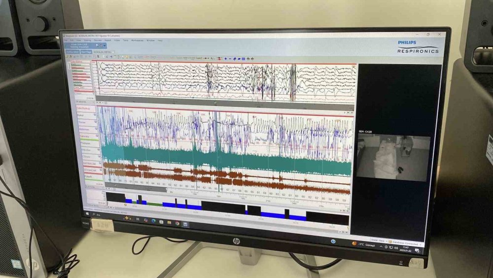 Şehir Hastanesi’nde Nöroloji Hastalarına İleri Tedavi İmkanları Sunuluyor