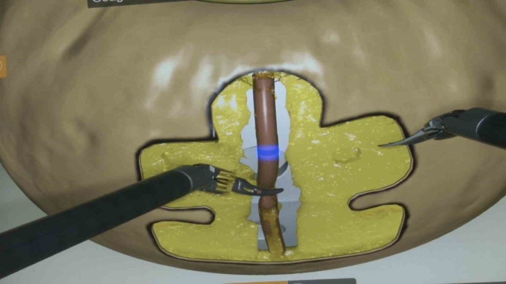 Robotik Ameliyat Uygulamaları Başladı